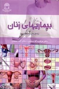 بیماریهای زنان (پاسخ به پرسشهای رایج)